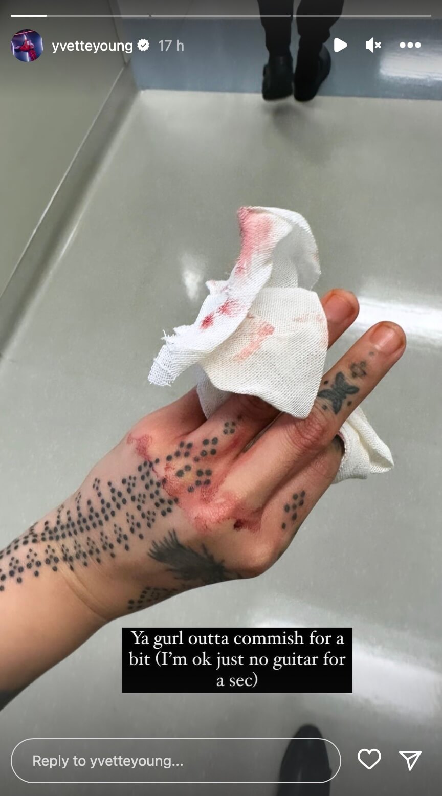 Yvette Young's finger covered in a slightly bloody bandage